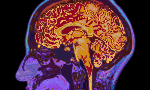 BREAKING: New Study Shows Dangers of Spike Protein Accumulation in the Brain