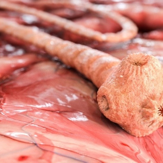 Up to One-Third Are Infected With This Parasite