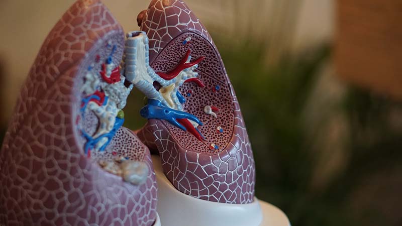 Nattokinase and Nigella Sativa Extract Show Promise in Treating Pulmonary Fibrosis