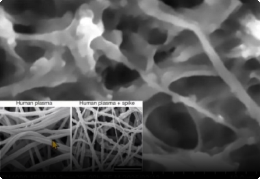 Calamari Clots SEM Microstructure